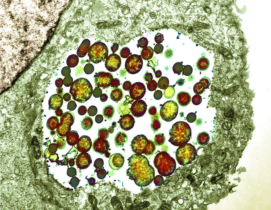 Chlamydia Trachomatis Photograph - Chlamydia Trachomatis Bacteria, Tem #3 by Biomedical Imaging Unit, Southampton General Hospital