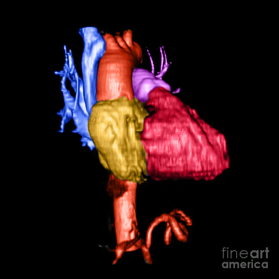 Color Enhanced 3d Cta Of Heart #3 Photograph by Medical Body Scans