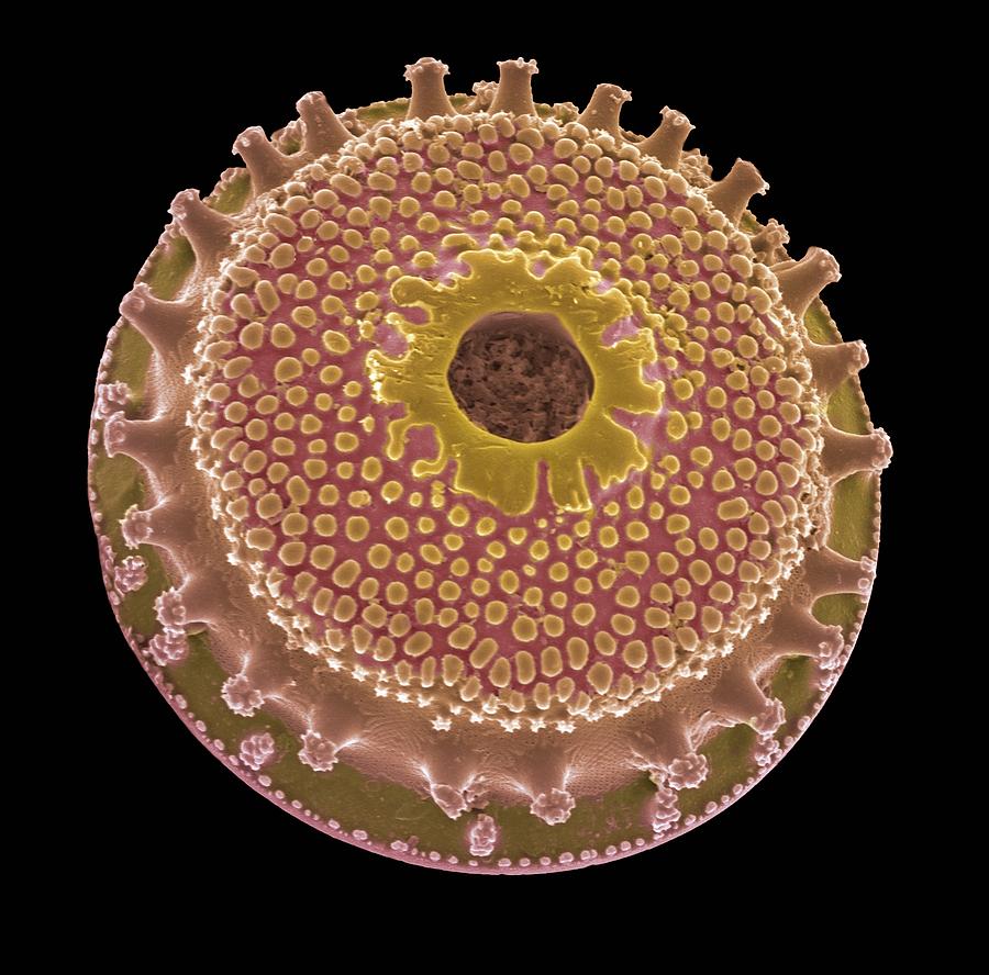 Nature Photograph - Diatom, Sem #3 by Steve Gschmeissner