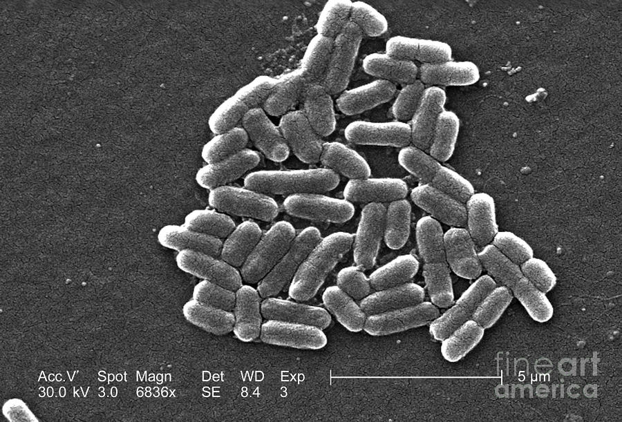 Escherichia Coli O157h7 Bacteria, Sem #3 Photograph by Science Source