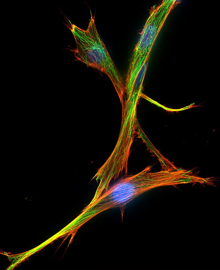 Fibroblast Cells, Fluorescent Micrograph #3 Photograph by Dr Torsten Wittmann
