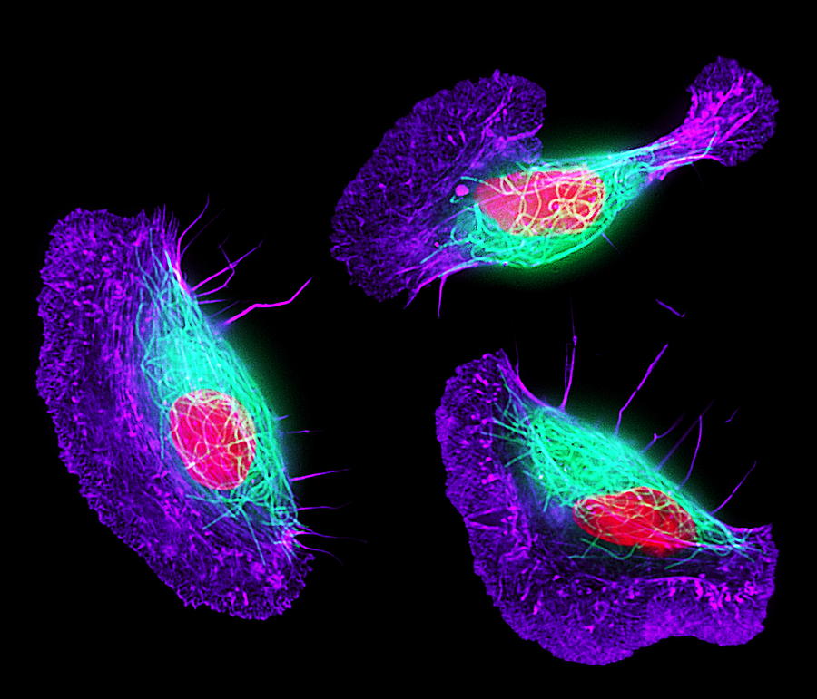 Fish Skin Cells Photograph by Dr Torsten Wittmann