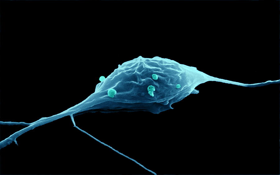 Granule Nerve Cell, Sem #3 Photograph by David Mccarthy