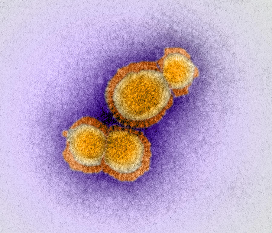 H5n1 Avian Influenza Virus Particles, Tem Photograph By Dr Klaus Boller ...