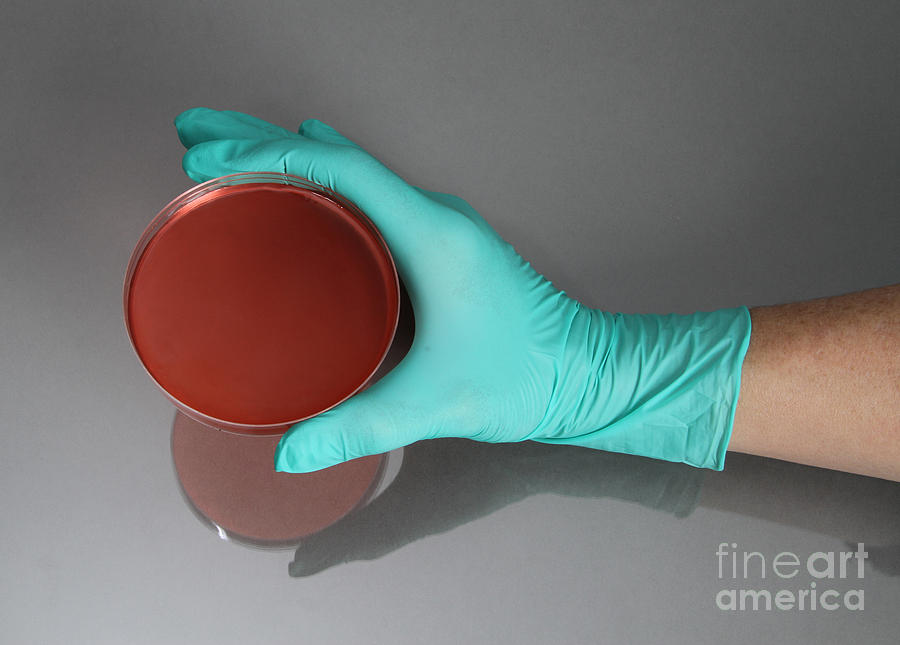 Hand Holding Petri Dish #3 Photograph by Photo Researchers