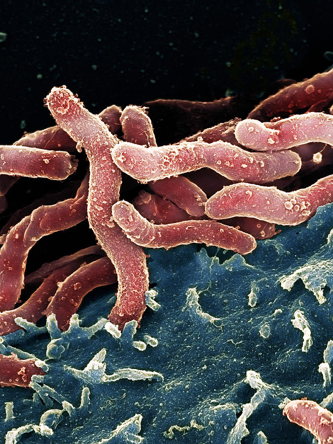 Helicobacter Pylori Photograph - Helicobacter Pylori Bacteria, Sem #3 by 