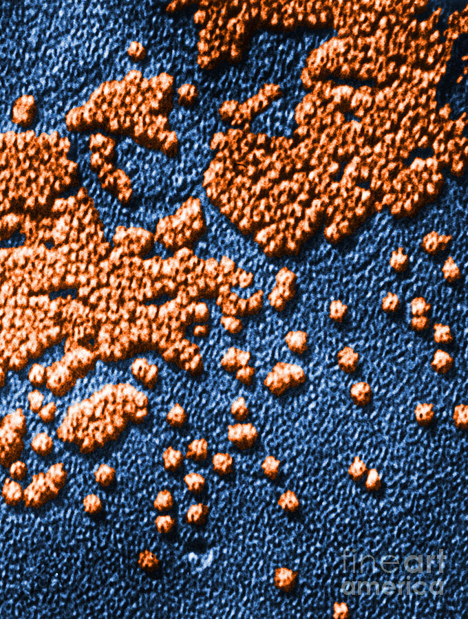 Hepatitis Virus #3 Photograph by Omikron