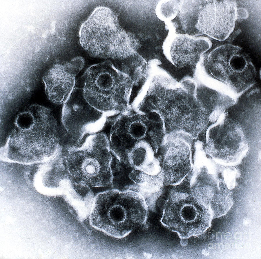Herpes Simplex Virus Tem #3 Photograph by ASM/Science Source