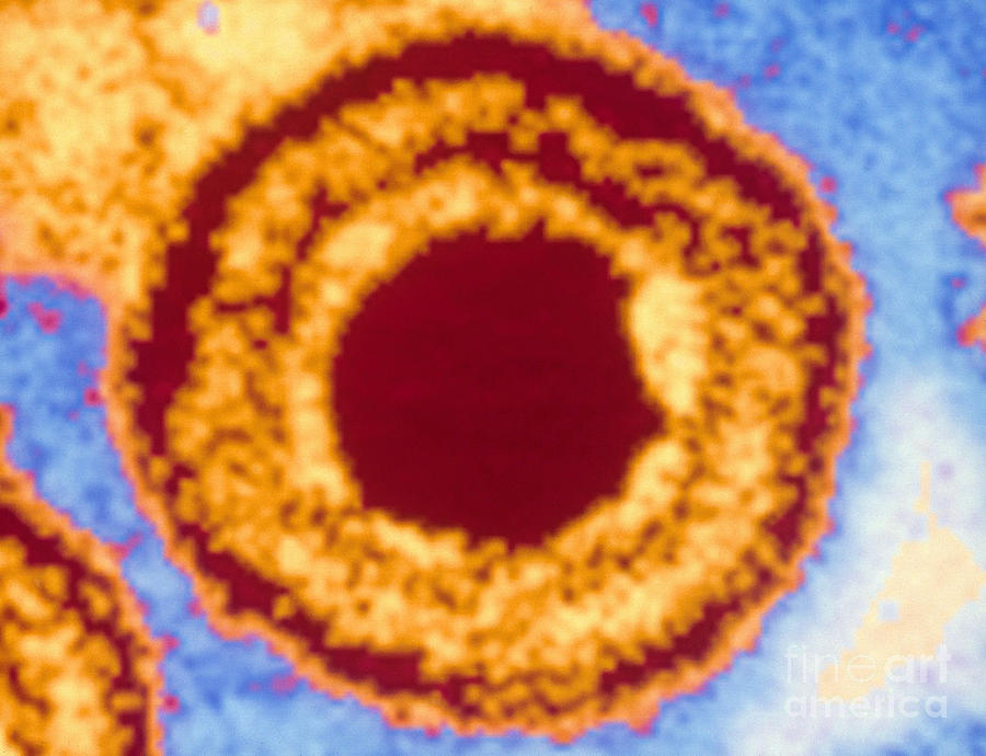 Herpes Simplex Virus Tem #3 Photograph by Science Source