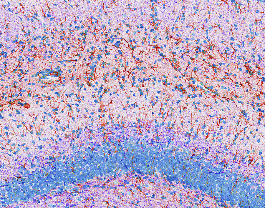 Hippocampus Photograph - Hippocampus Brain Tissue #3 by Thomas Deerinck, Ncmir