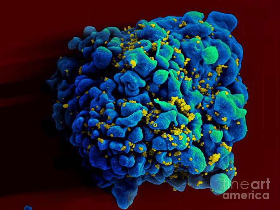 Hiv-infected H9 T Cell, Sem #7 Photograph by Science Source