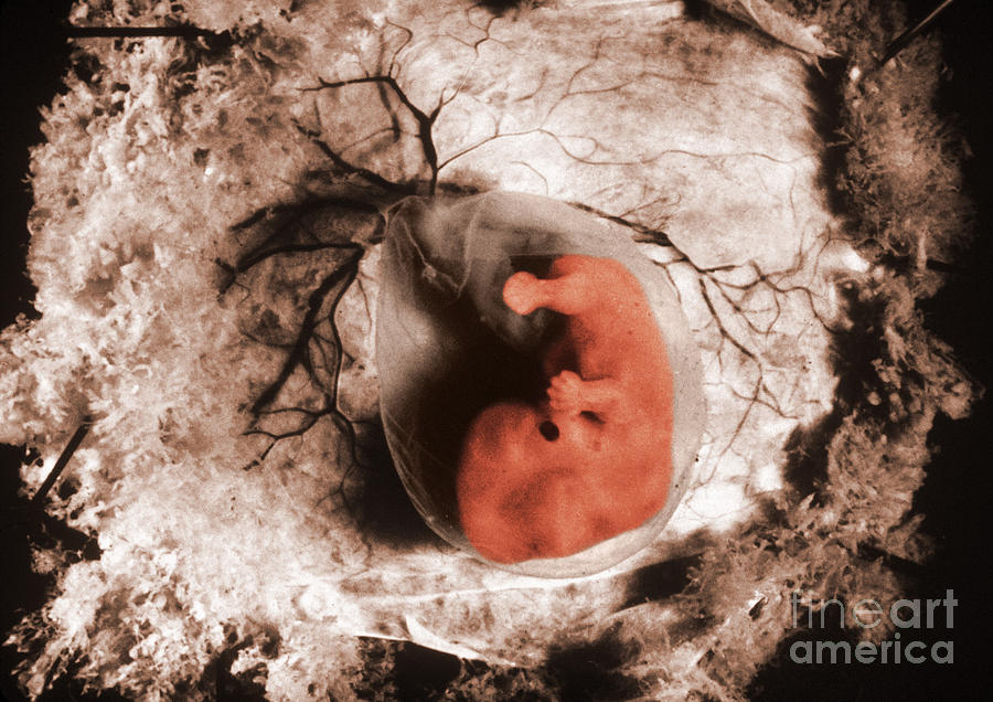 Human Embryo #3 Photograph by Omikron