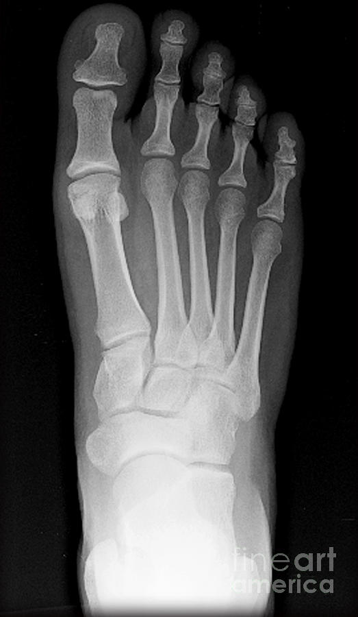 Human Foot Photograph by Medical Body Scans - Fine Art America