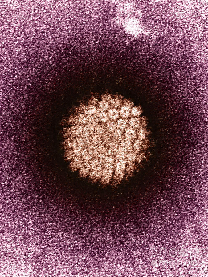 Electron Micrograph Photograph - Human Papilloma Virus Hpv #3 by Science Source