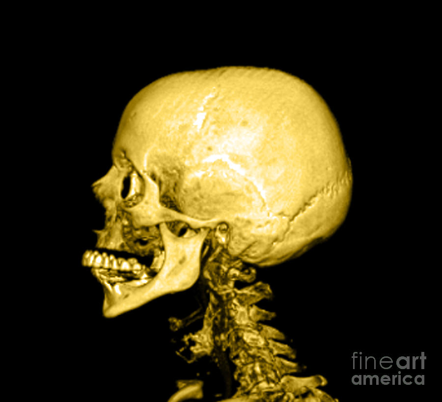 Skull Photograph - Human Skull #3 by Medical Body Scans