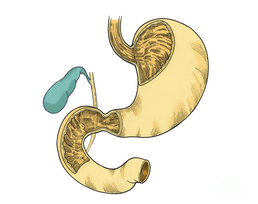 Anatomy Photograph - Illustration Of Stomach And Duodenum #3 by Science Source
