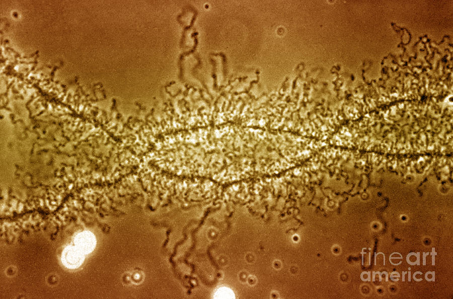 Lampbrush Chromosome #3 Photograph by Omikron