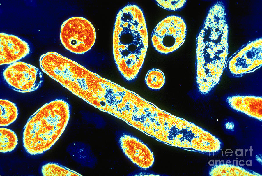 Legionella Pneumophila #3 Photograph by Science Source