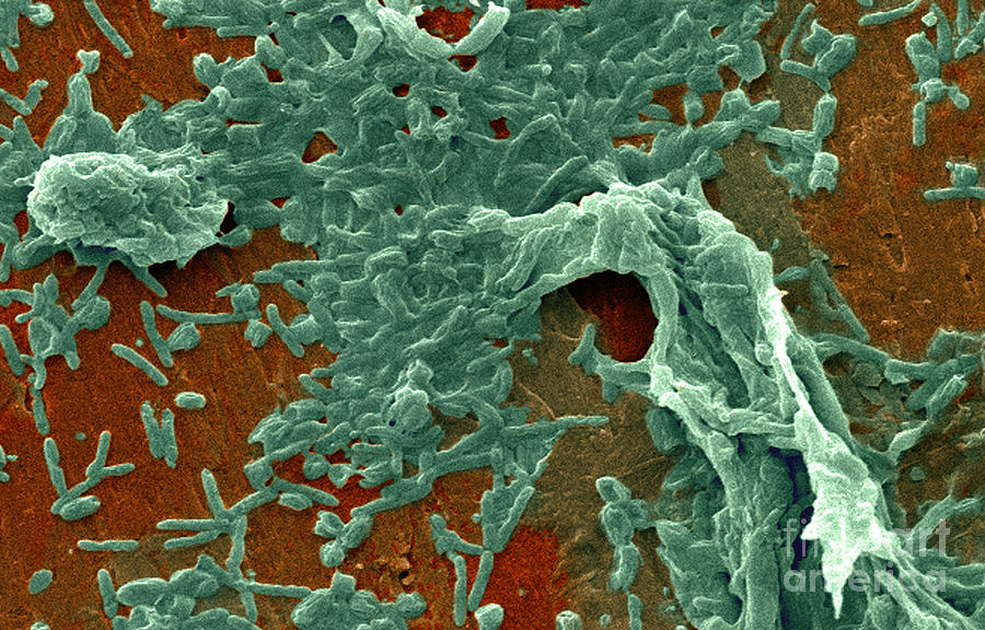 Science Photograph - Legionella Pneumophila Sem #3 by Science Source