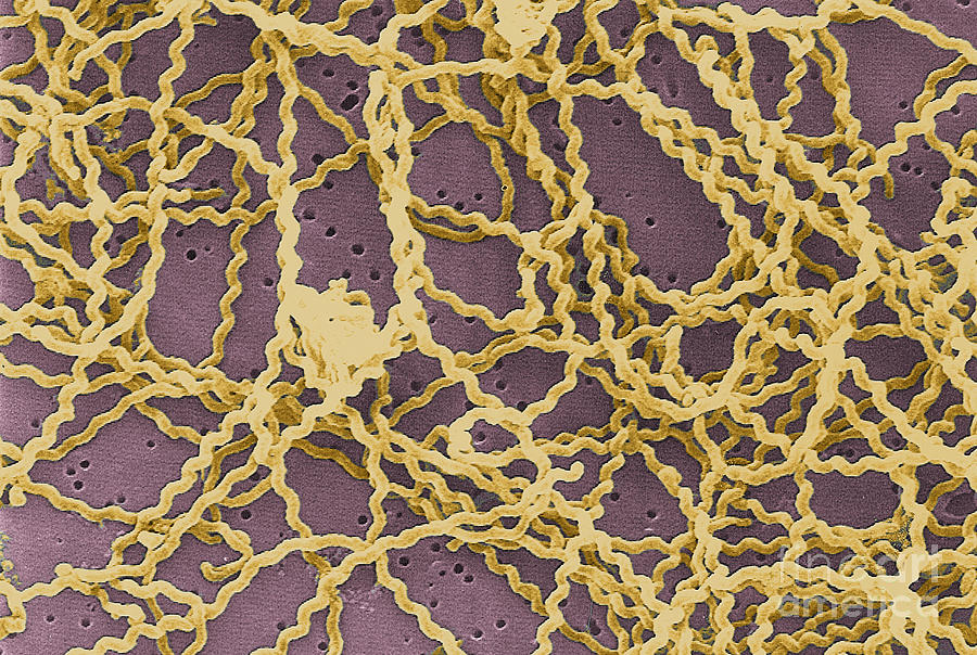 Leptospira #3 Photograph by Science Source