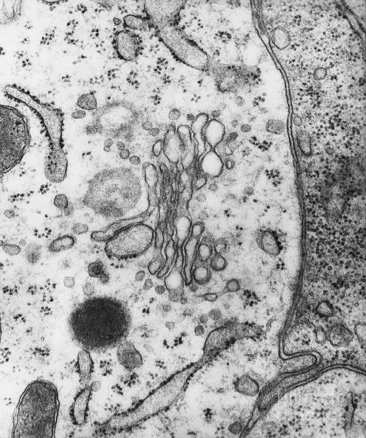 Lysosomes, Tem #3 Photograph by Science Source