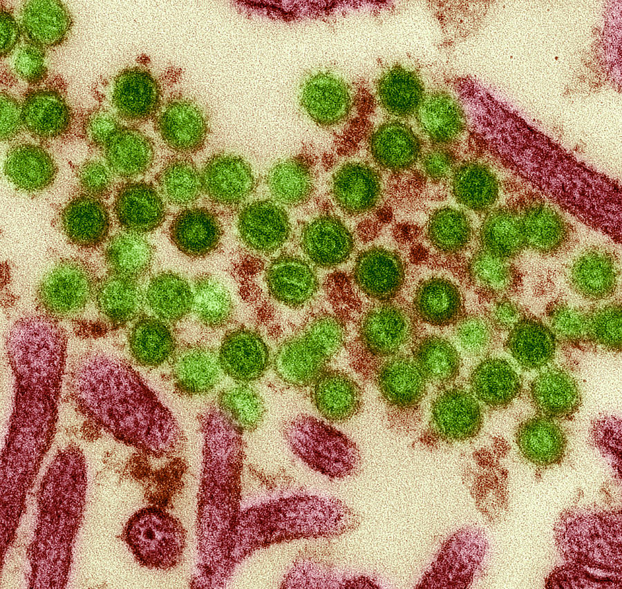 Retrovirus Photograph - Mouse Leukaemia Viruses, Tem #3 by Steve Gschmeissner