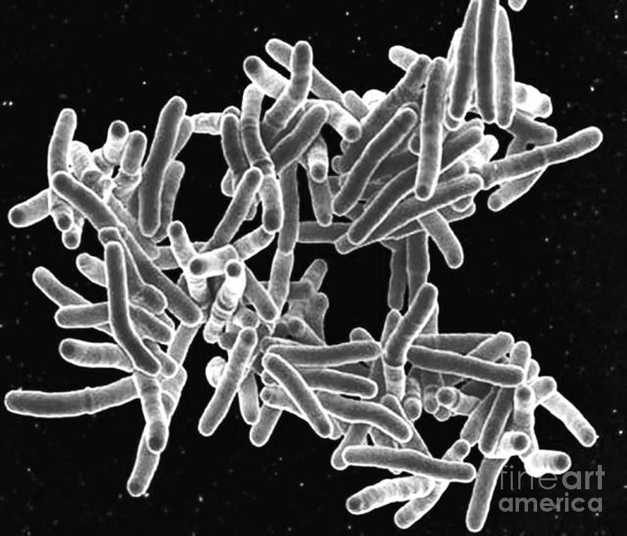 Mycobacterium Tuberculosis Bacteria, Sem #3 Photograph by Science Source