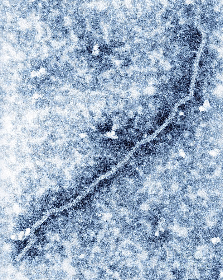 Nipah Virus #3 Photograph by Science Source