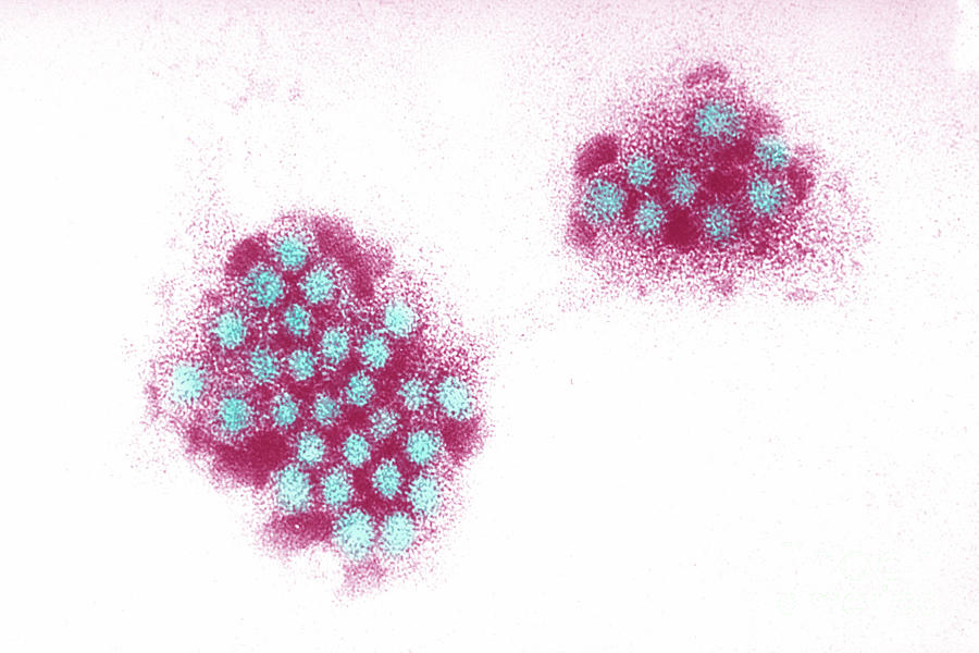 Варицелла-зостер вирус. Калицивирусы микробиология. Вирус Норуолк.
