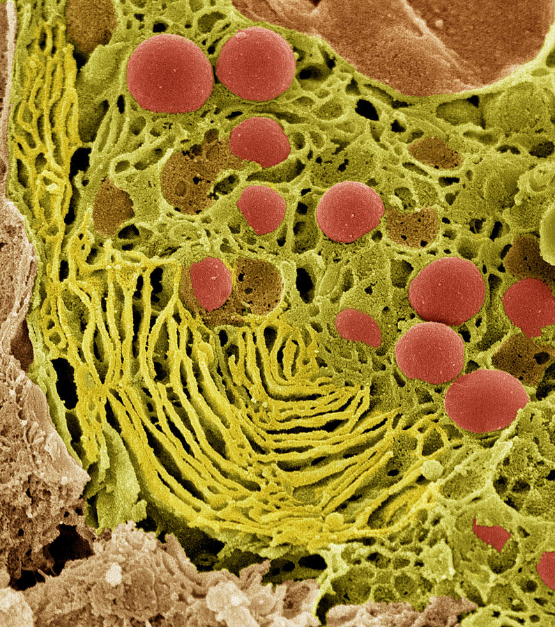 Pancreas Cell, Sem Photograph by Steve Gschmeissner