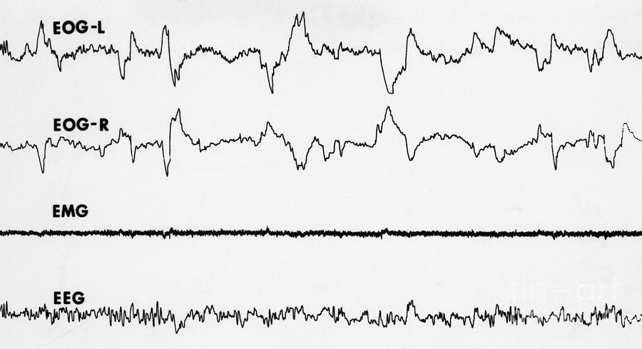 Polygraph Tracings Of Rem Sleep #3 Photograph by Omikron