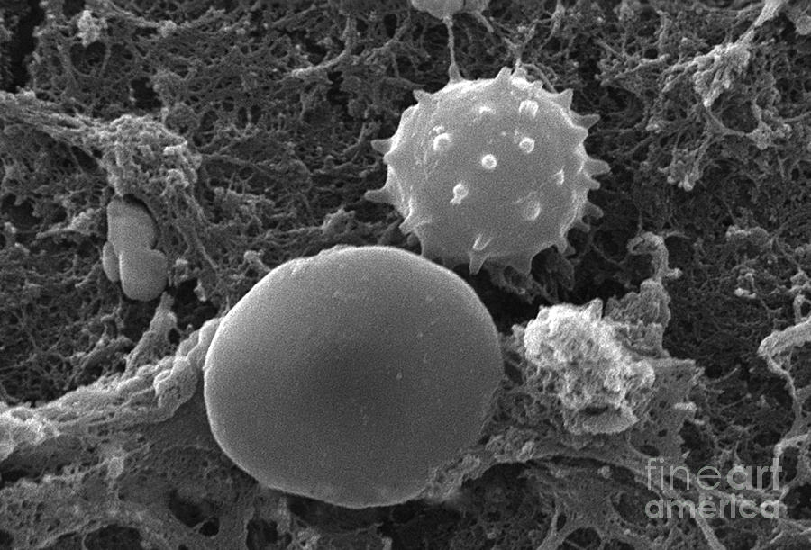 Red And White Blood Cells, Sem #3 Photograph by Science Source