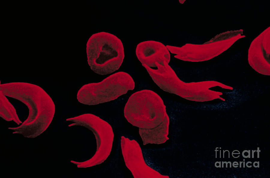 Red Blood Cells #3 Photograph by Omikron