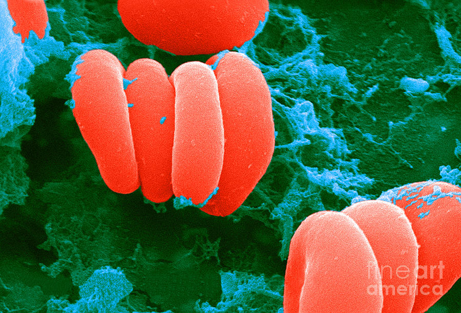 Red Blood Cells, Rouleaux Formation, Sem #3 Photograph by Science Source
