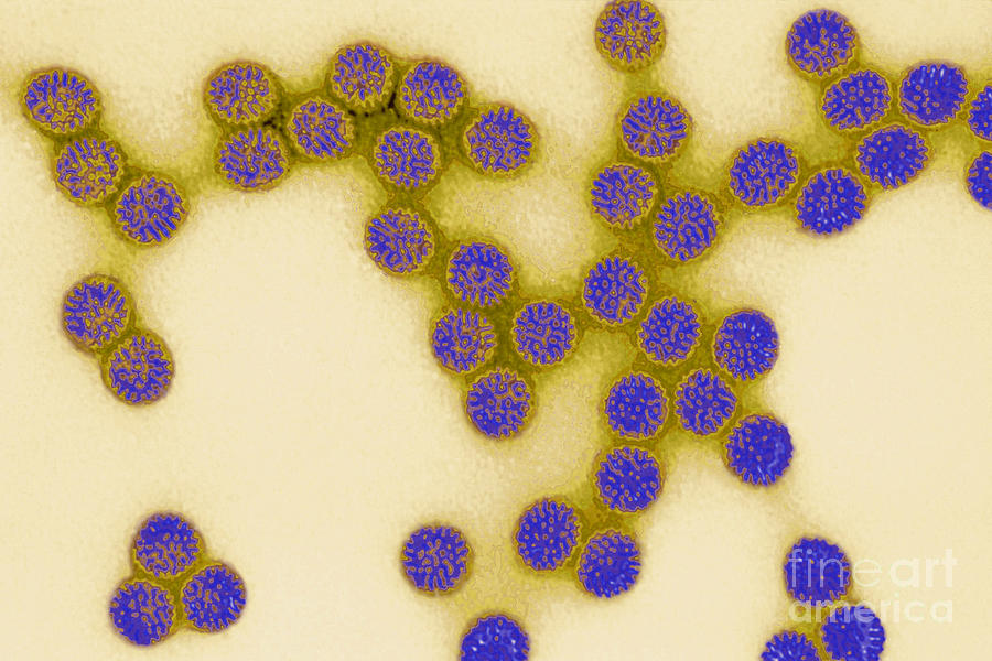 Rotavirus #3 Photograph by Science Source