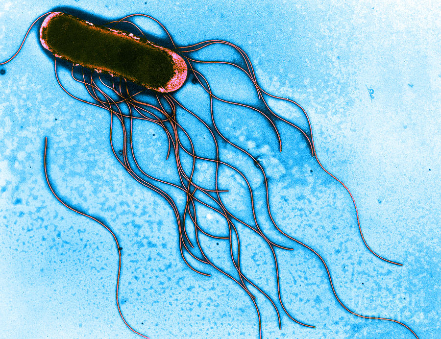 Salmonella by Science Source.