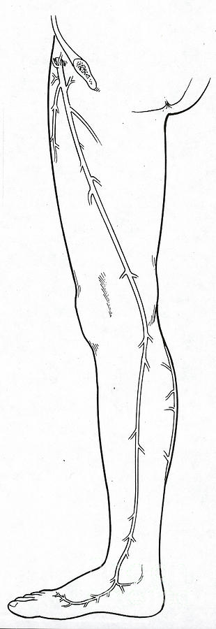 Saphenous Vein #3  by Science Source