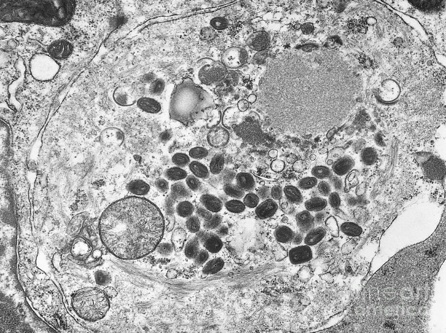 Smallpox Virus, Tem #3 Photograph by Science Source