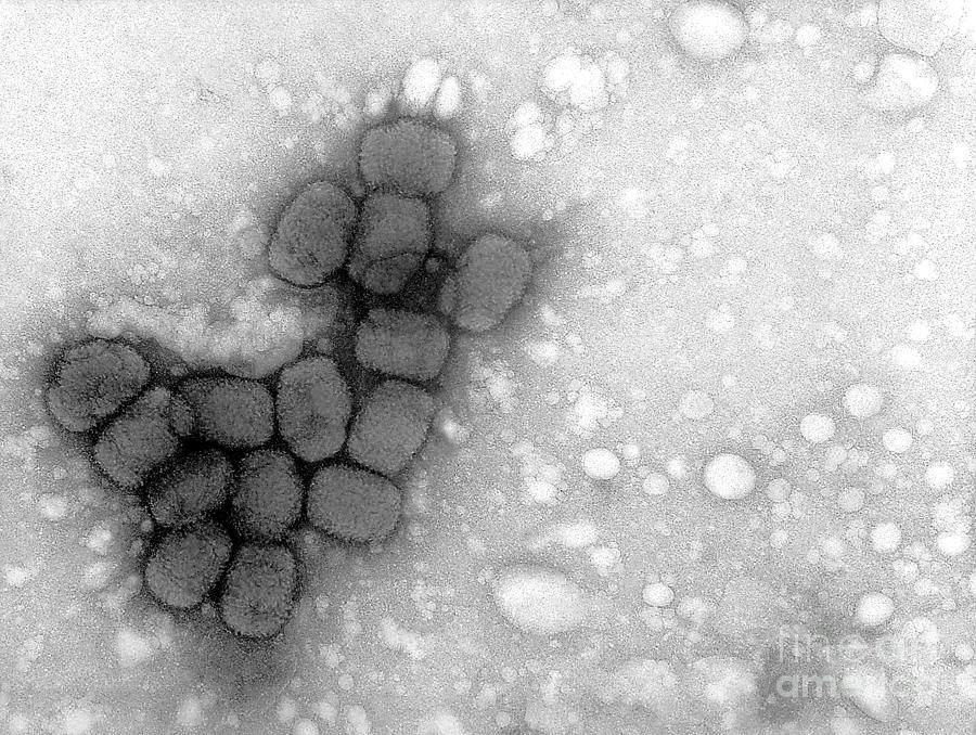 Smallpox Viruses, Tem #3 Photograph by Science Source