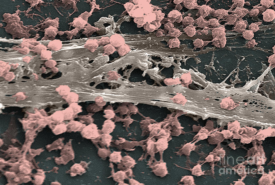 Staphylococcus Aureus Bacteria, Sem #3 Photograph by Science Source