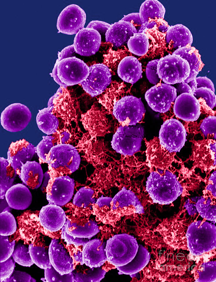 Staphylococcus Epidermidis Bacteria, Sem #3 Photograph by Science Source