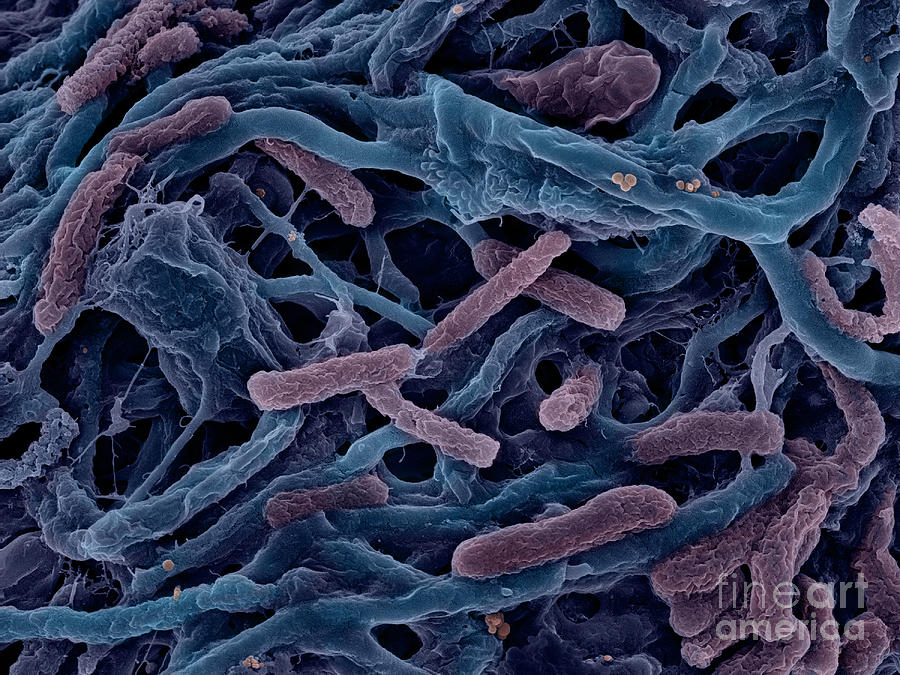Bacteria Photograph - Thermophile Bacteria #3 by Ted Kinsman