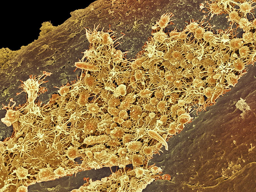 Micro-organisms Photograph - Tongue Bacteria, Sem #3 by Steve Gschmeissner