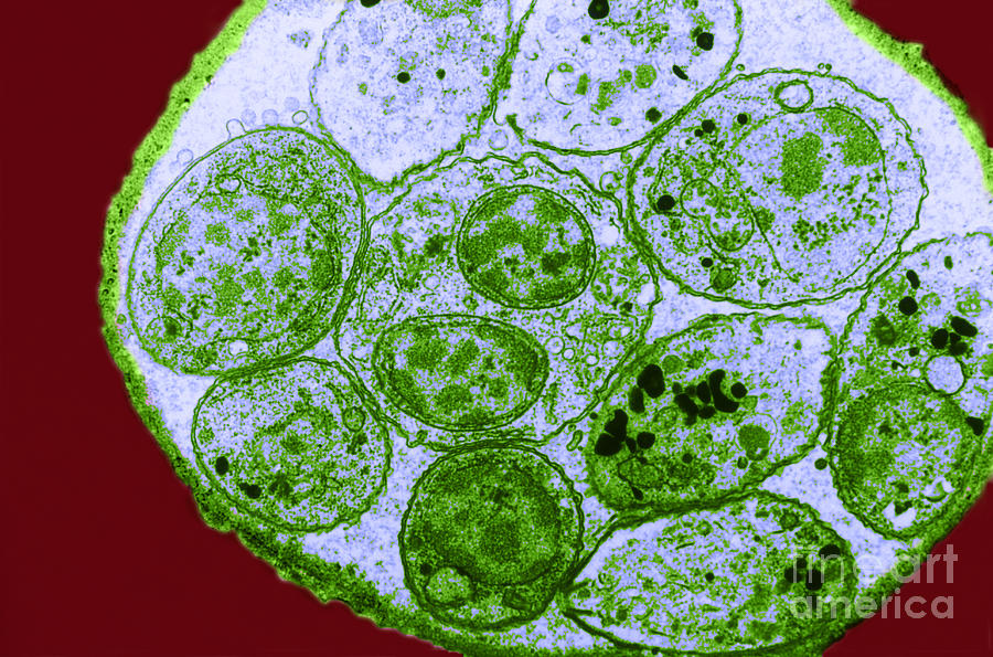 Toxoplasma Cyst Tem Photograph by Science Source | Fine Art America