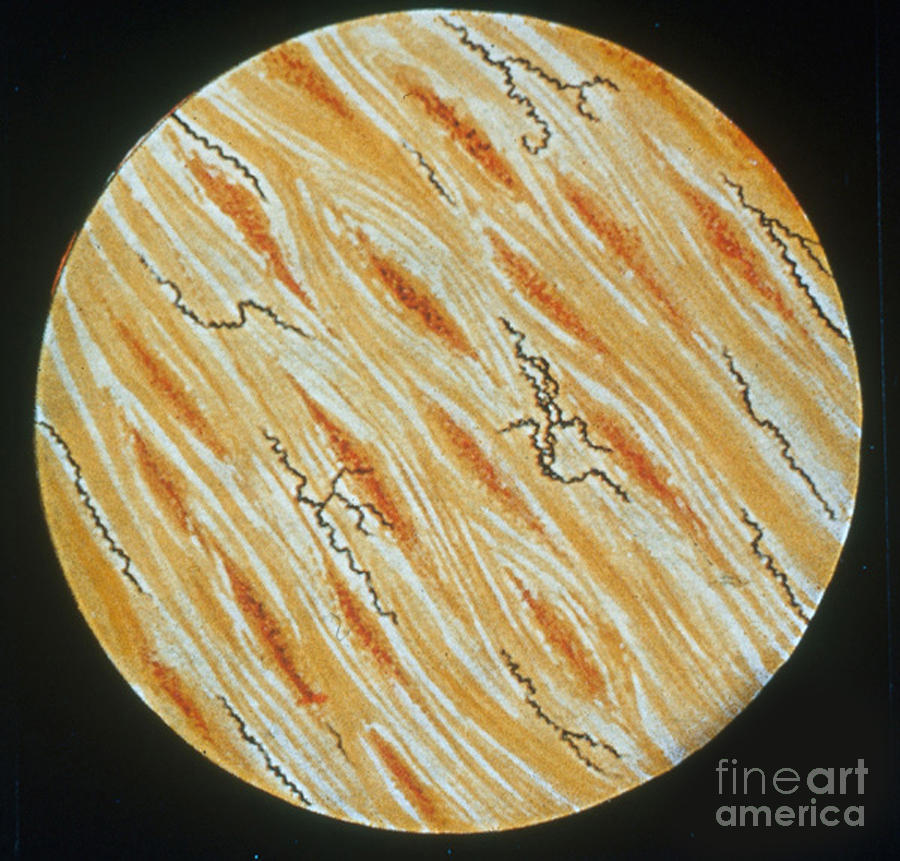 Treponema Pallidum #3 Photograph by Science Source