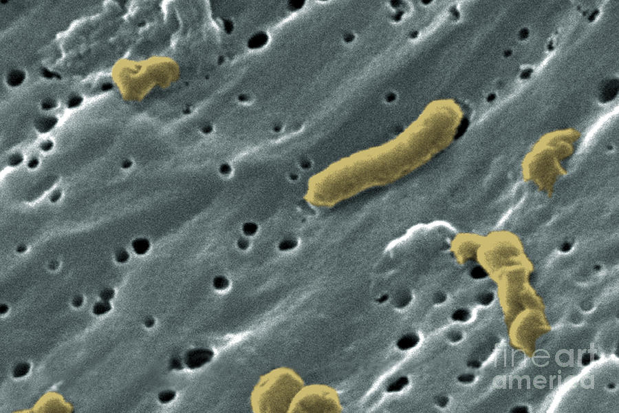 Vibrio Cholerae Bacteria, Sem #3 Photograph by Science Source