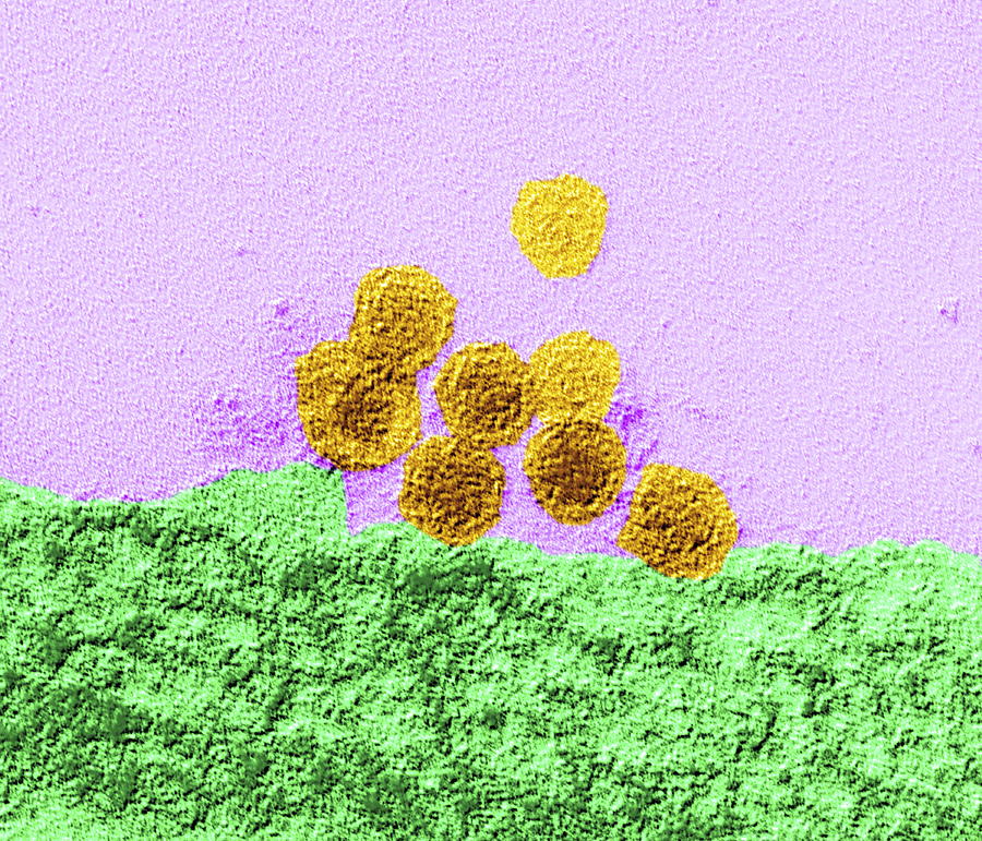 West Nile Virus, Tem #3 Photograph by Dr Klaus Boller - Fine Art America