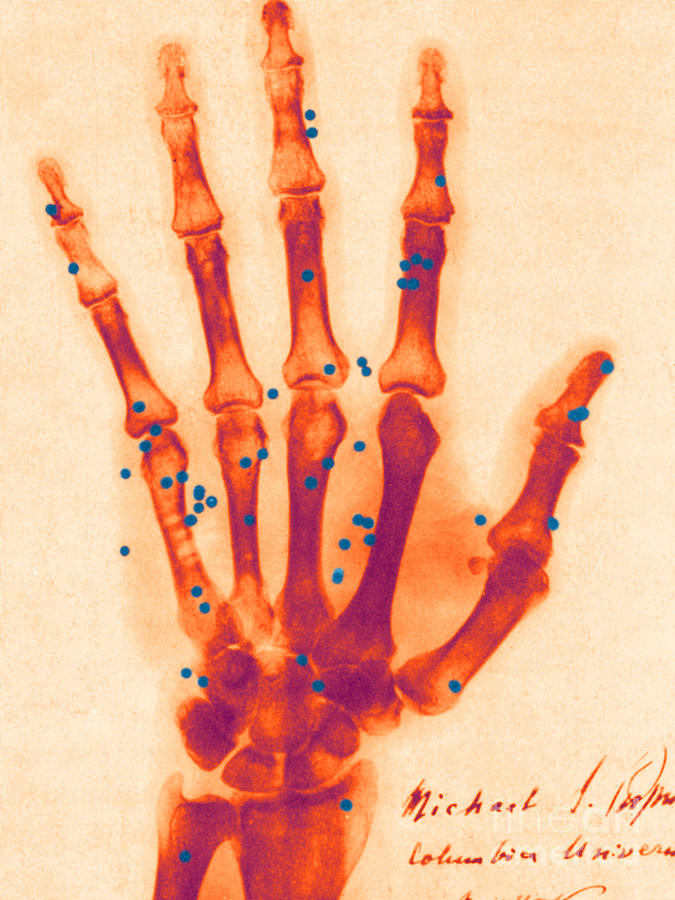 X-ray Of Gunshot In The Hand #4 Photograph by Science Source