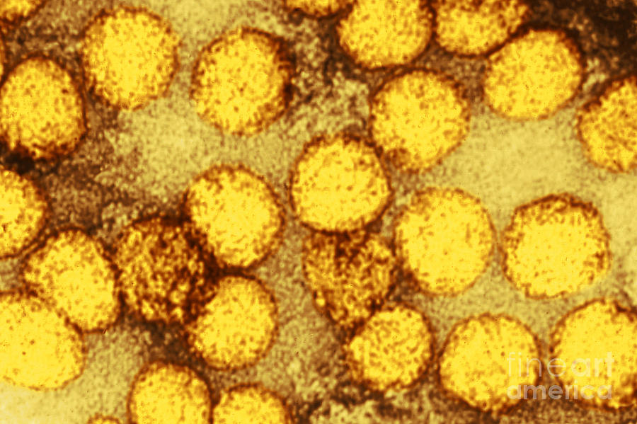 Yellow Fever Virus, Tem #3 Photograph by Science Source