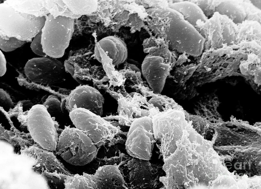 Yersinia Pestis Bacteria, Sem #3 Photograph by Science Source